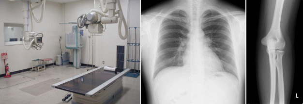 一般撮影室・胸部レントゲン・肘部レントゲンの写真画像