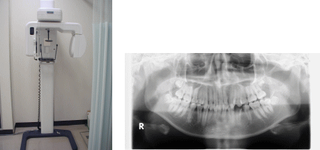 パノラマ撮影装置の写真とパノラマ撮影の画像