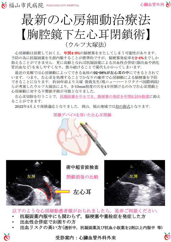 最新の心房細動治療法