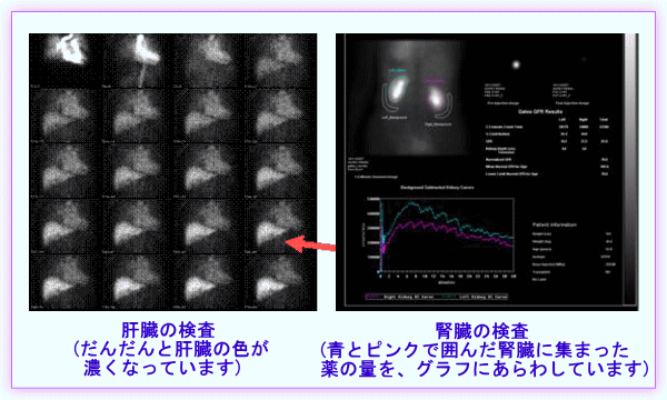 肝臓・腎臓の検査の写真