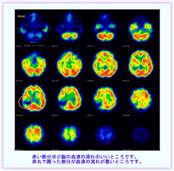 脳の検査の写真