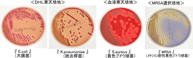 DHL寒天培地・血液寒天培地・MRSA選択培地