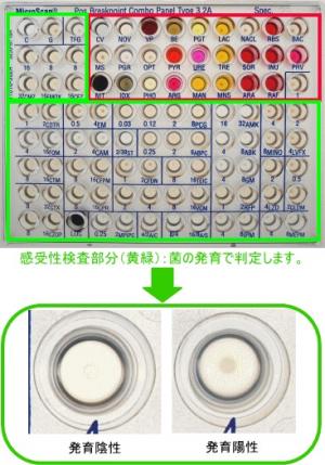 固定検査部分と感受性検査部分の画像1