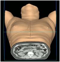 射野設定用CT撮影の画像3