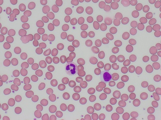 正常な白血球の画像