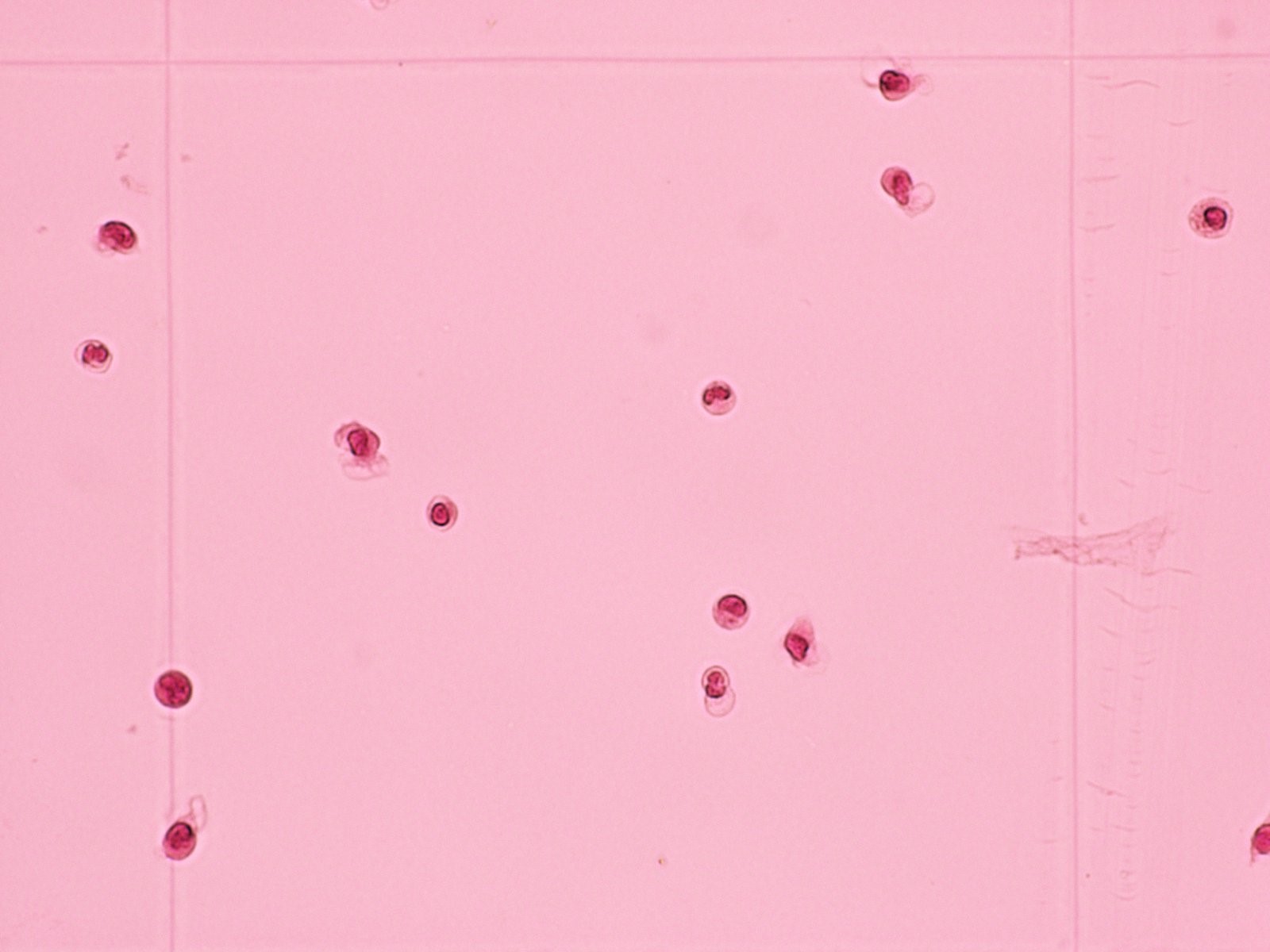 髄液中に見られる細胞（白血球）の画像