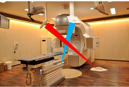 画像誘導放射線治療の写真