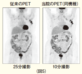 短時間で情報収集できる機能もあり、同じ撮影時間であればより鮮明な画像が得られます（図5）。