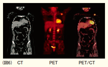 PET／CTのCT部分は64列の多列CTで、通常の診断用のCTと同様に高速、正確な画像を撮影できます（図6）。