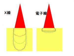 放射線照射実施。X線電子線