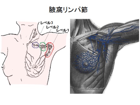 腋窩リンパ節