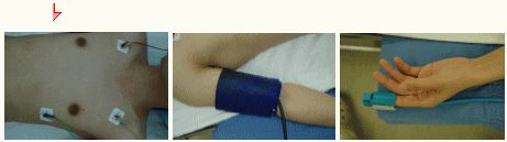 心電図のシール，血圧計のマンシェット(巻き物)，酸素飽和度モニタの写真