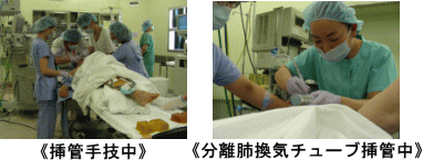 挿管手技中・分離肺換気チューブ挿管中の写真