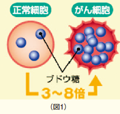 悪性腫瘍が多くのFDGを取り込み、そこから放出される微量の放射線をPET画像でとらえて、悪性腫瘍の位置、病変の広がり等を調べることができます（図1）。