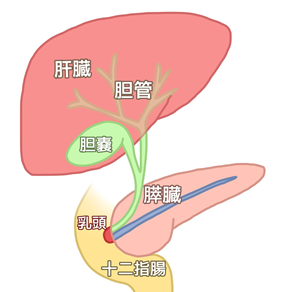 膵がんの画像