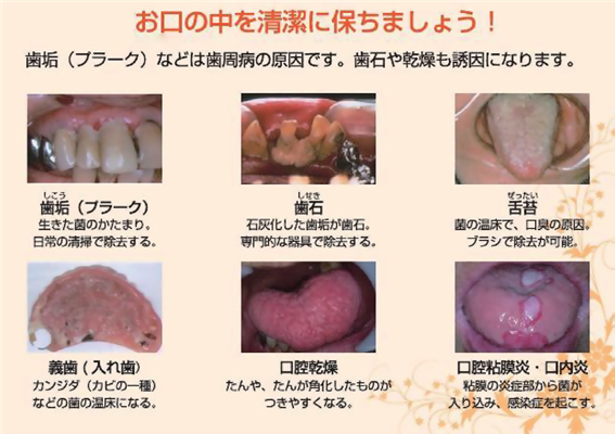 お口の中を清潔に保ちましょう